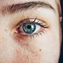 Managing Dry Skin Conditions - Tips and Ingredients