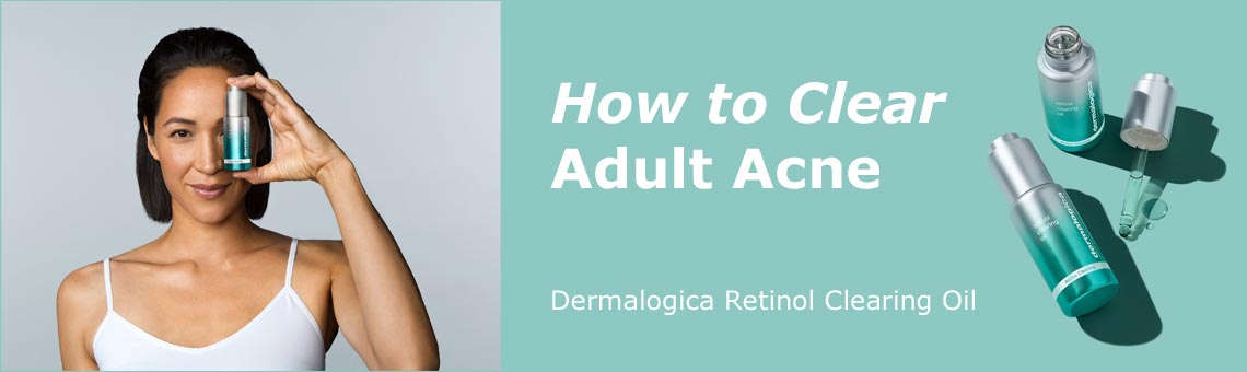 How To Clear Adult Acne With Dermalogica Retinol Clearing Oil