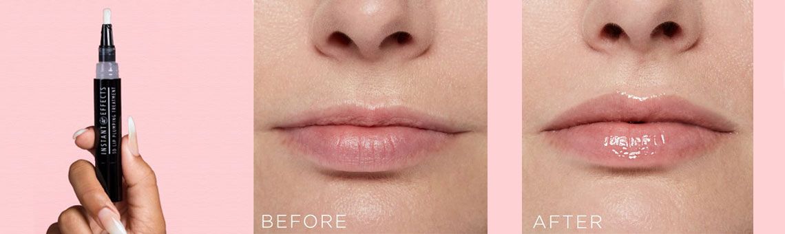 Fuller Lips Without The Needle?