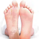 Introducing Baby Foot