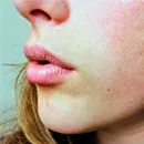 Why Your Skin Barrier Struggles in Winter and How to Support It