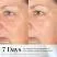 Clinical Study Before And After 7 Days