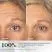Clinical Study Before And After 14 Days