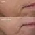 Before And After 8 Weeks