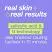 Real Skin Results