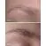 Before And After